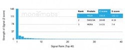 Mesothelin, Mouse anti-Human,Mouse,Rat, Clone: MSLN/2131, Novus Biologicals:Antibodies:Primary